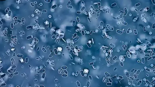 What Causes Uric Acid to Increase?